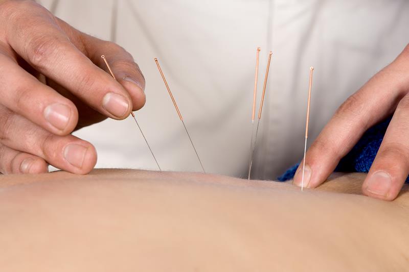Chiropractor in Humble, TX - Acupuncture
