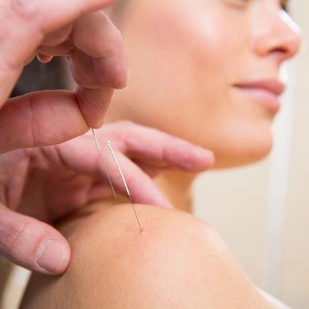 Massage Therapy Humble TX Acupuncture